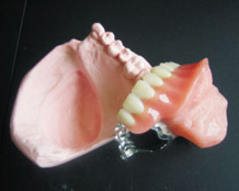 Partial Denture