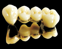 Noble metal porcelain